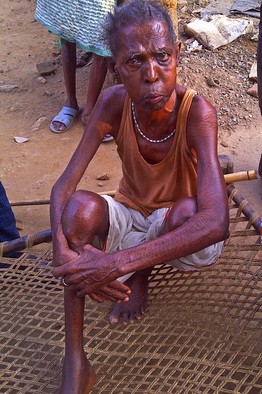 Starving in India: The Forgotten Problem Starving in India: The Forgotten Problem